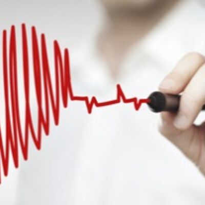 Bild vergrößern: drawing chart heartbeat_© peshkova - Fotolia.com _46042626